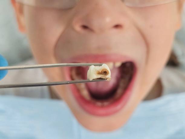 Best Emergency Dental Care for Trauma or Injury in Summer Set, MO